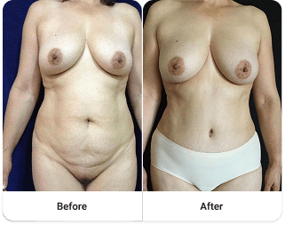 Before and after 8